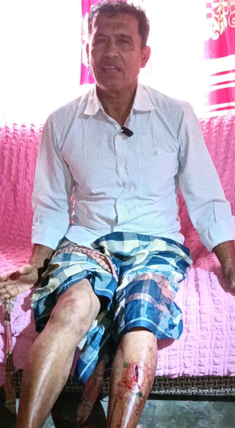 লালমোহনে জমি বিরোধের জের ধরে প্রধান শিক্ষককে কুপিয়ে আহত 
